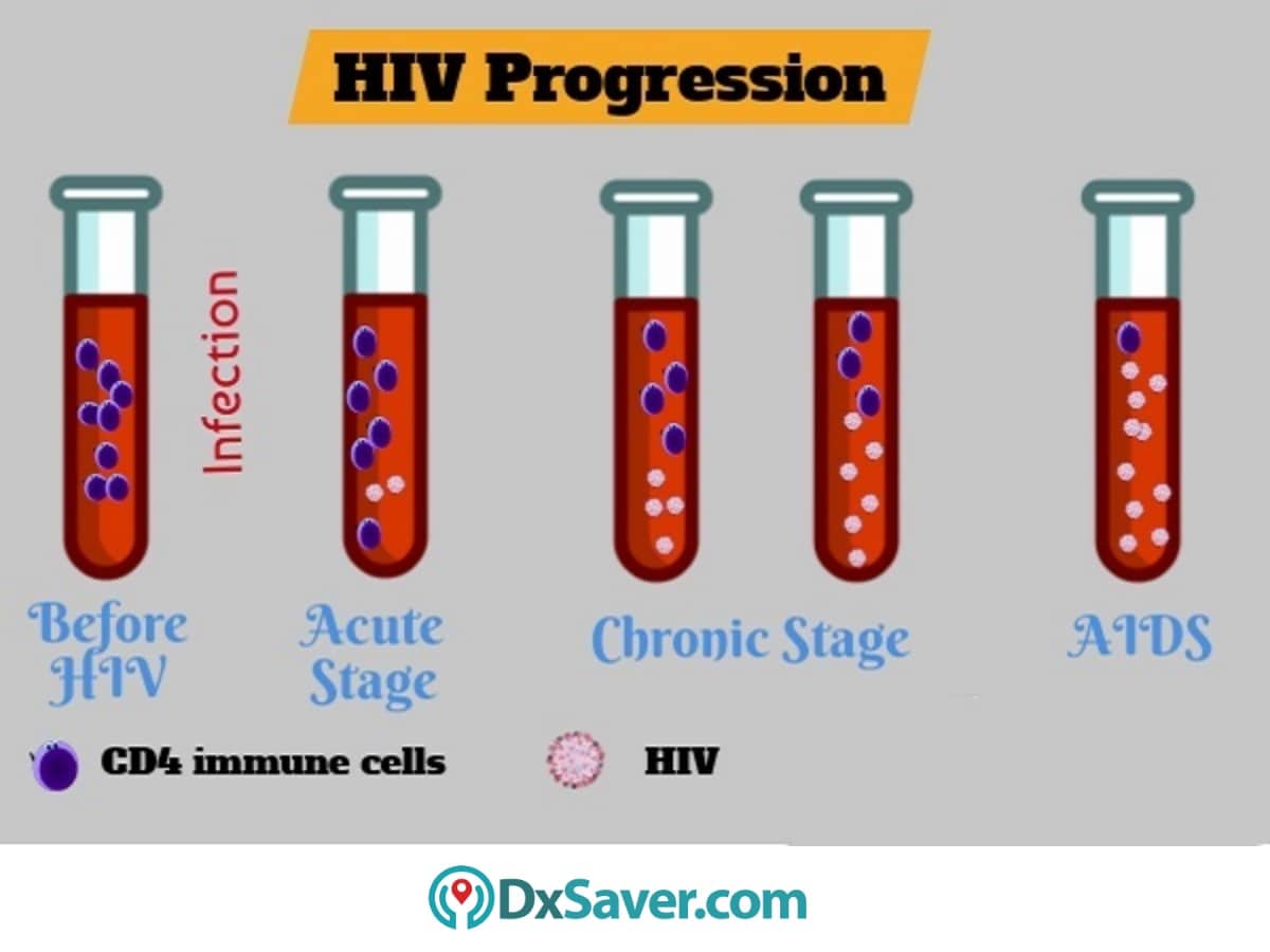 HIV Test Cost at $69 | Fast, Private & Affordable Testing - DxSaver.com