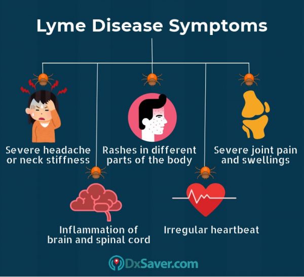 Get Lowest Lyme Disease Test Cost at $91 | Book Online Now – DxSaver.com