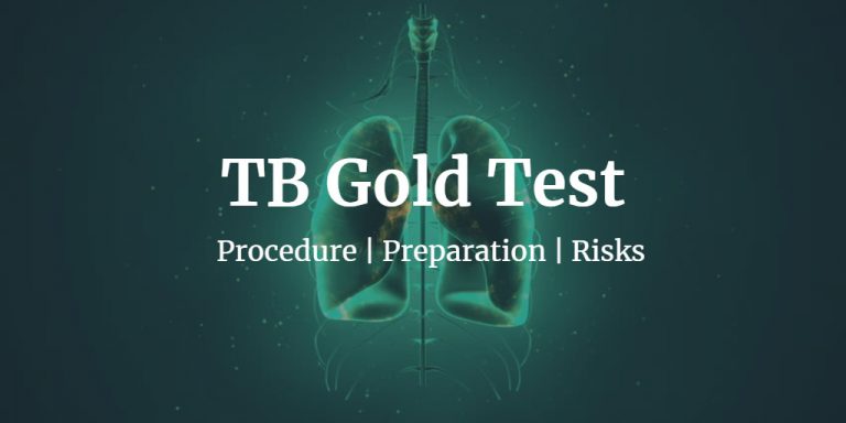 how-much-does-a-tb-gold-test-cost-near-me-dxsaver