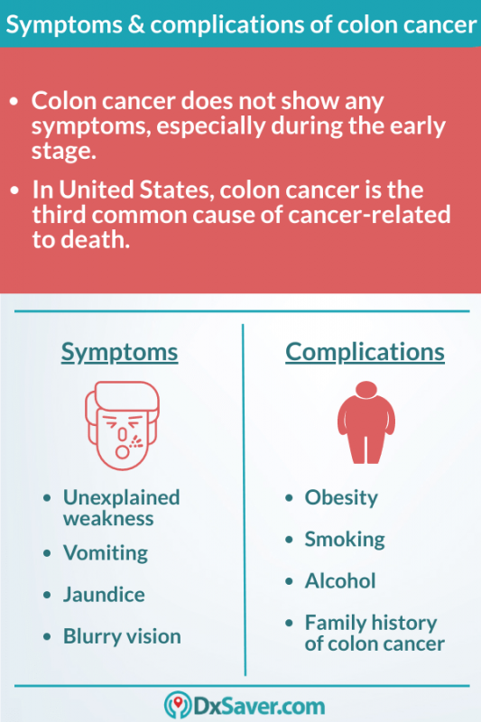 What Are The Stages Of Colon Cancer? Know More About The Causes ...