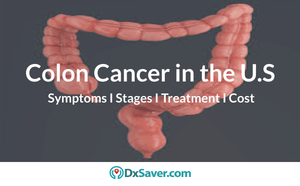 Colon Cancer I Stages, Symptoms, Causes, Treatment And Test Cost