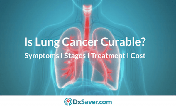 What Are The Lung Cancer Stages Read More About Lung Cancer Symptoms Types Treatment