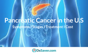 Pancreatic Cancer I Stages, Causes, Treatment, Prevention and Test Cost