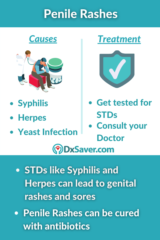 Is Penile Rash A Symptom Of STD Know More On Causes Test Cost