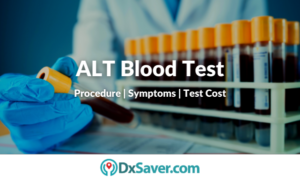 ALT Blood Test – Test Cost, Procedure and Preparation – DxSaver.com