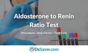 Aldosterone to Renin Ratio Test – Procedure, Preparation and More ...