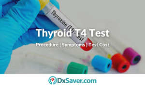 What is a Thyroid T4 Test? – Purpose, Procedure, Test Cost and More ...