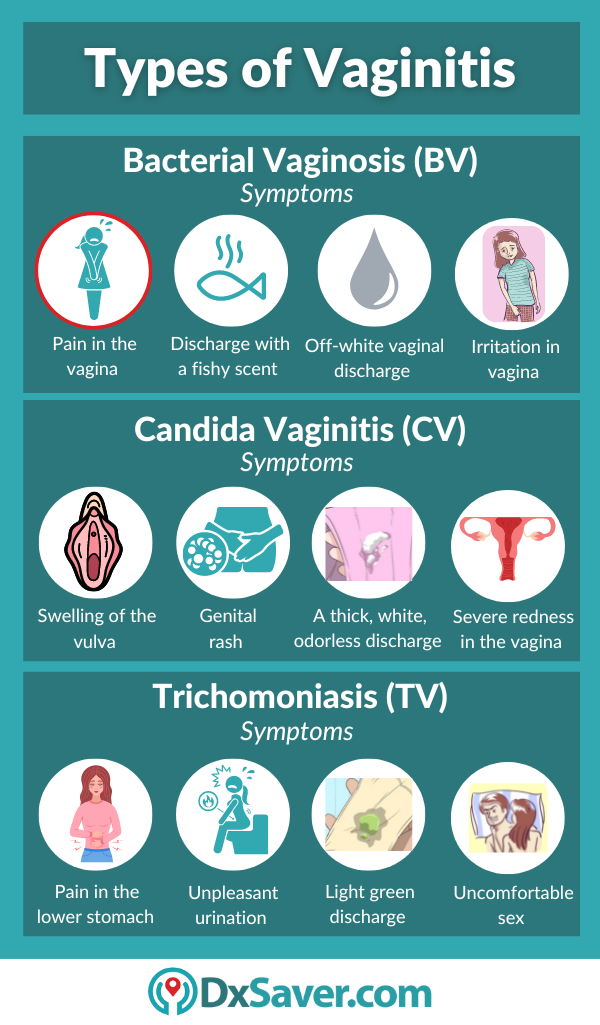 Vaginitis Test Symptoms Causes Vaginal Health And Vaginitis Testing Cost